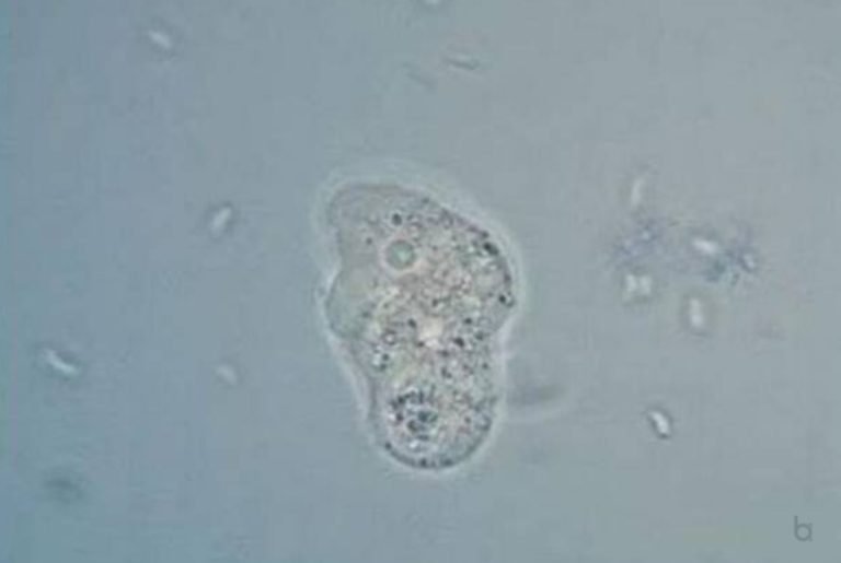 Brain-Eating Amoeba