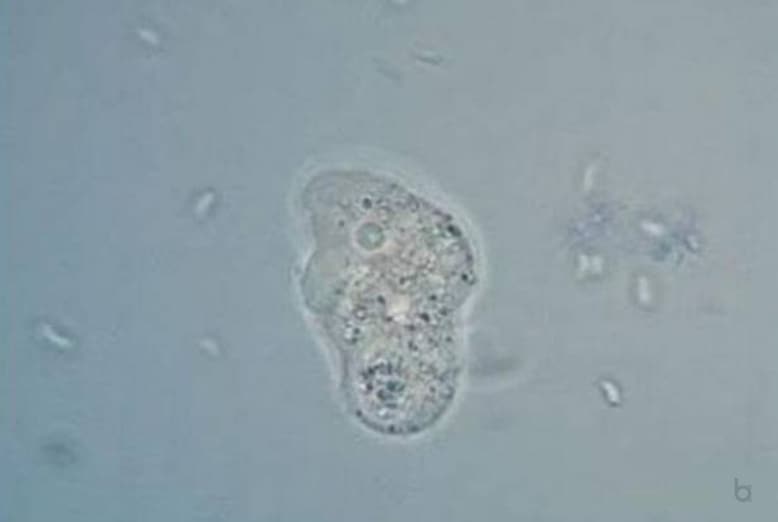Brain-Eating Amoeba