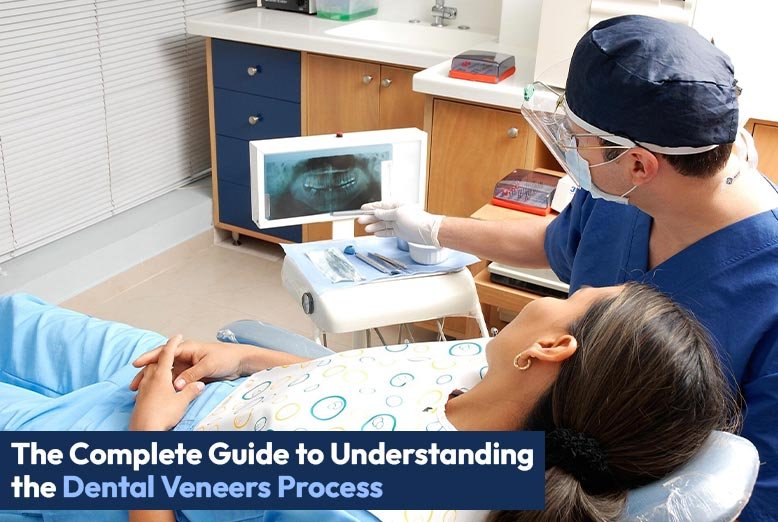 Dental Veneers Process