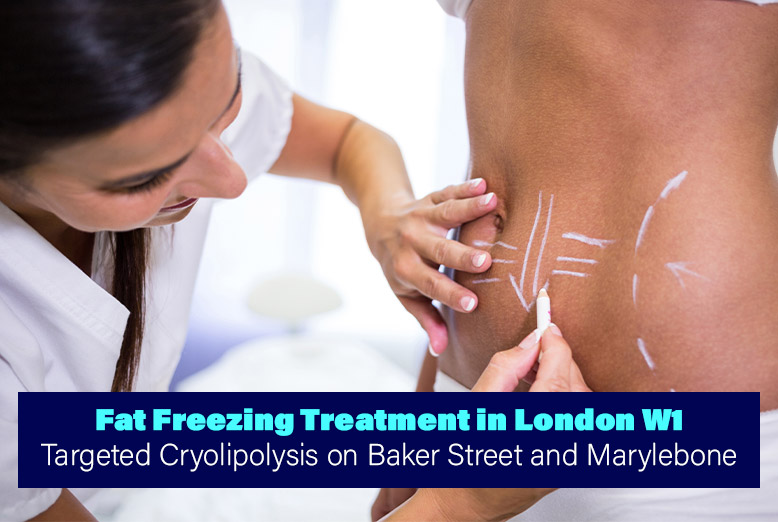 Fat Freezing Treatment